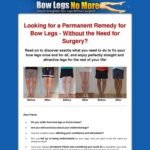 Bow Legs No More – How to Straighten Your Legs Without Surgery!